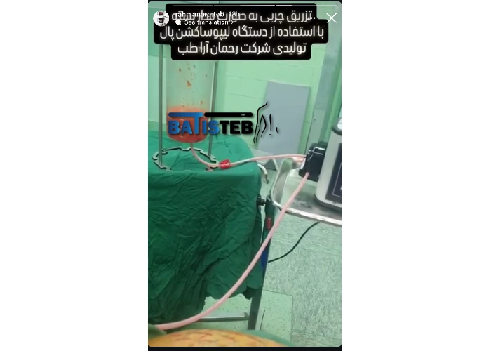 ویبرالیپو چیست؟